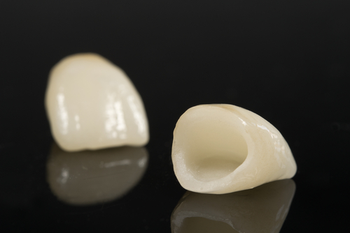 Dental Ceramic Crowns