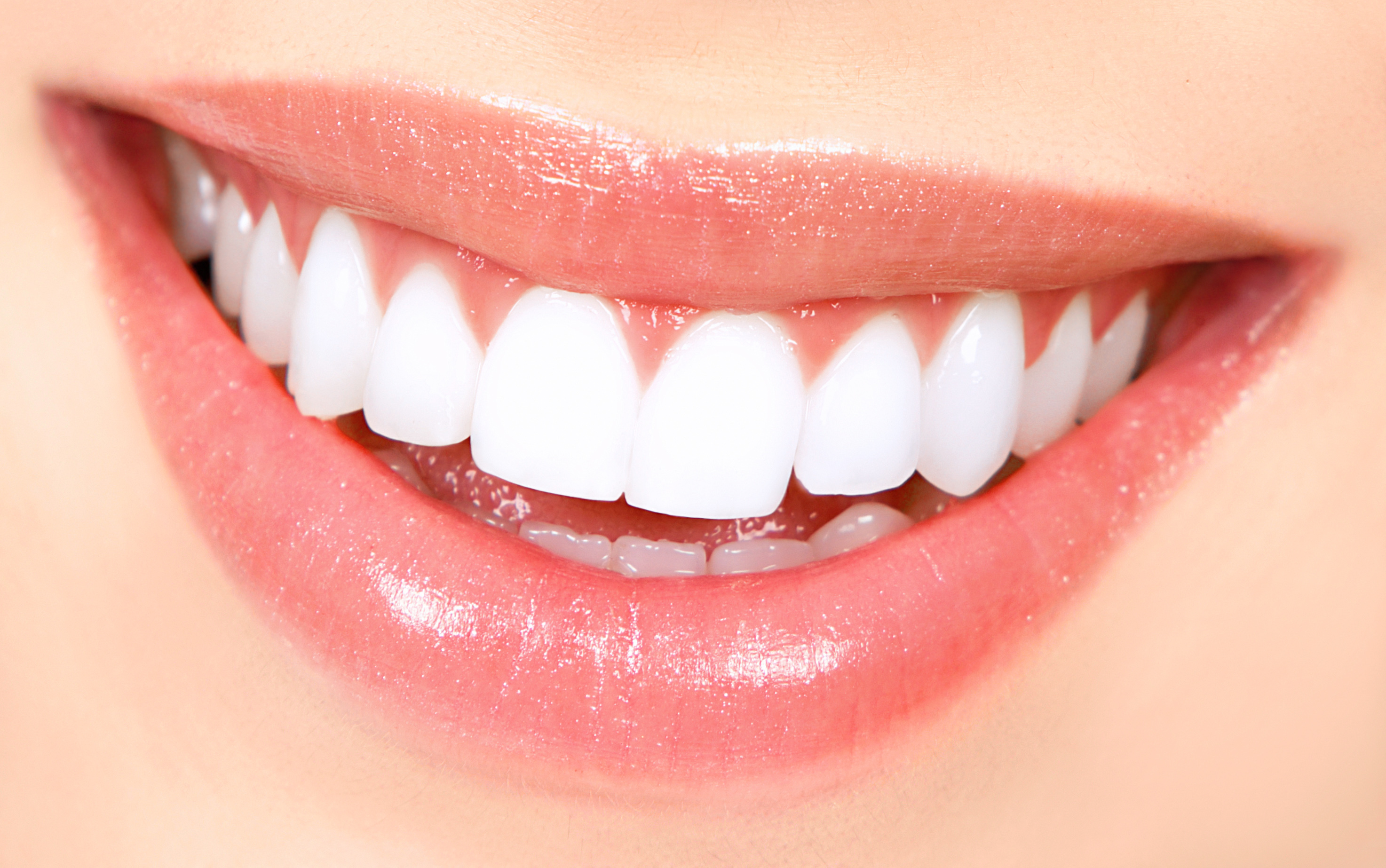 Dental Whitening